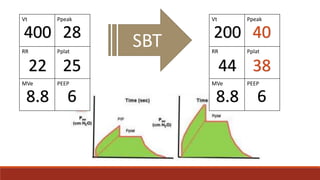 Vt Ppeak
RR Pplat
MVe PEEP
400 28
2522
8.8 6
SBT
Vt Ppeak
RR Pplat
MVe PEEP
200 40
3844
8.8 6
 