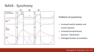 NAVA - Synchrony
Problems of asynchrony
• Increased need of sedation and
muscle relaxants
• Increased transpulmonary
pressure – Barotrauma
• Prolonged duration of ventilation
Verbrugghe W. Respiratory Care. 2011
 