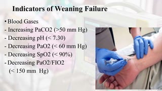 Indicators of Weaning Failure
• Blood Gases
- Increasing PaCO2 (>50 mm Hg)
- Decreasing pH (< 7.30)
- Decreasing PaO2 (< 60 mm Hg)
- Decreasing SpO2 (< 90%)
- Decreasing PaO2/FIO2
(< 150 mm Hg)
 
