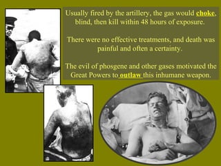 Usually fired by the artillery, the gas would choke,
blind, then kill within 48 hours of exposure.
There were no effective treatments, and death was
painful and often a certainty.
The evil of phosgene and other gases motivated the
Great Powers to outlaw this inhumane weapon.
 