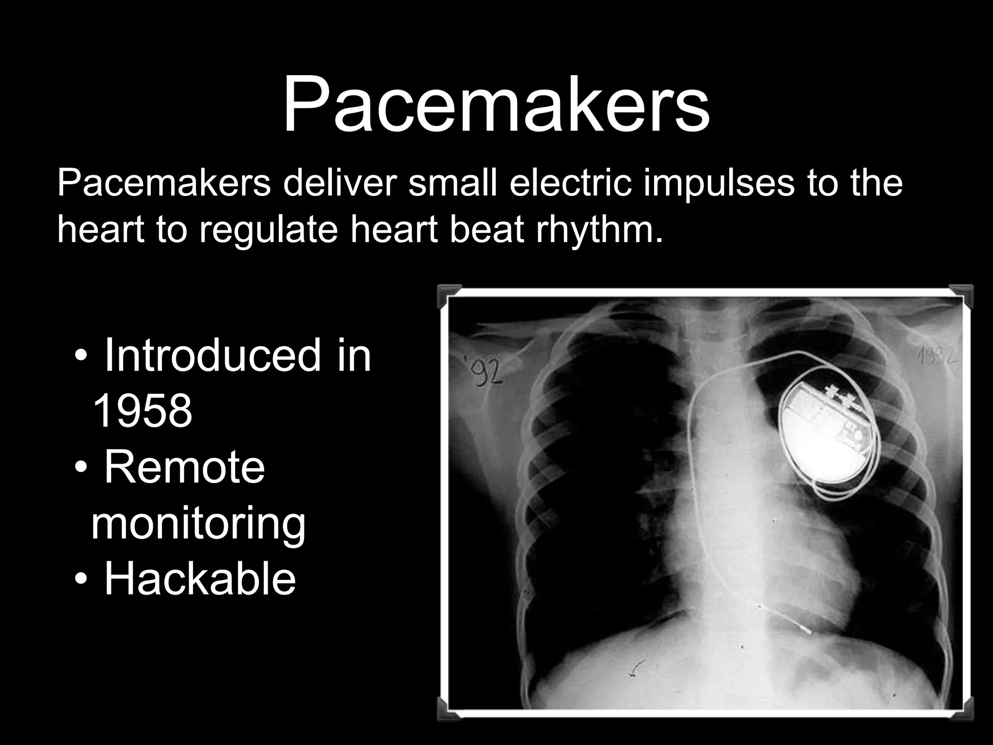 Pacemakers
Pacemakers deliver small electric impulses to the
heart to regulate heart beat rhythm.
• Introduced in
1958
• Remote
monitoring
• Hackable
 