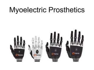 Myoelectric Prosthetics
 