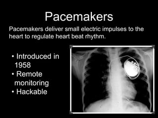 Pacemakers
Pacemakers deliver small electric impulses to the
heart to regulate heart beat rhythm.
• Introduced in
1958
• Remote
monitoring
• Hackable
 