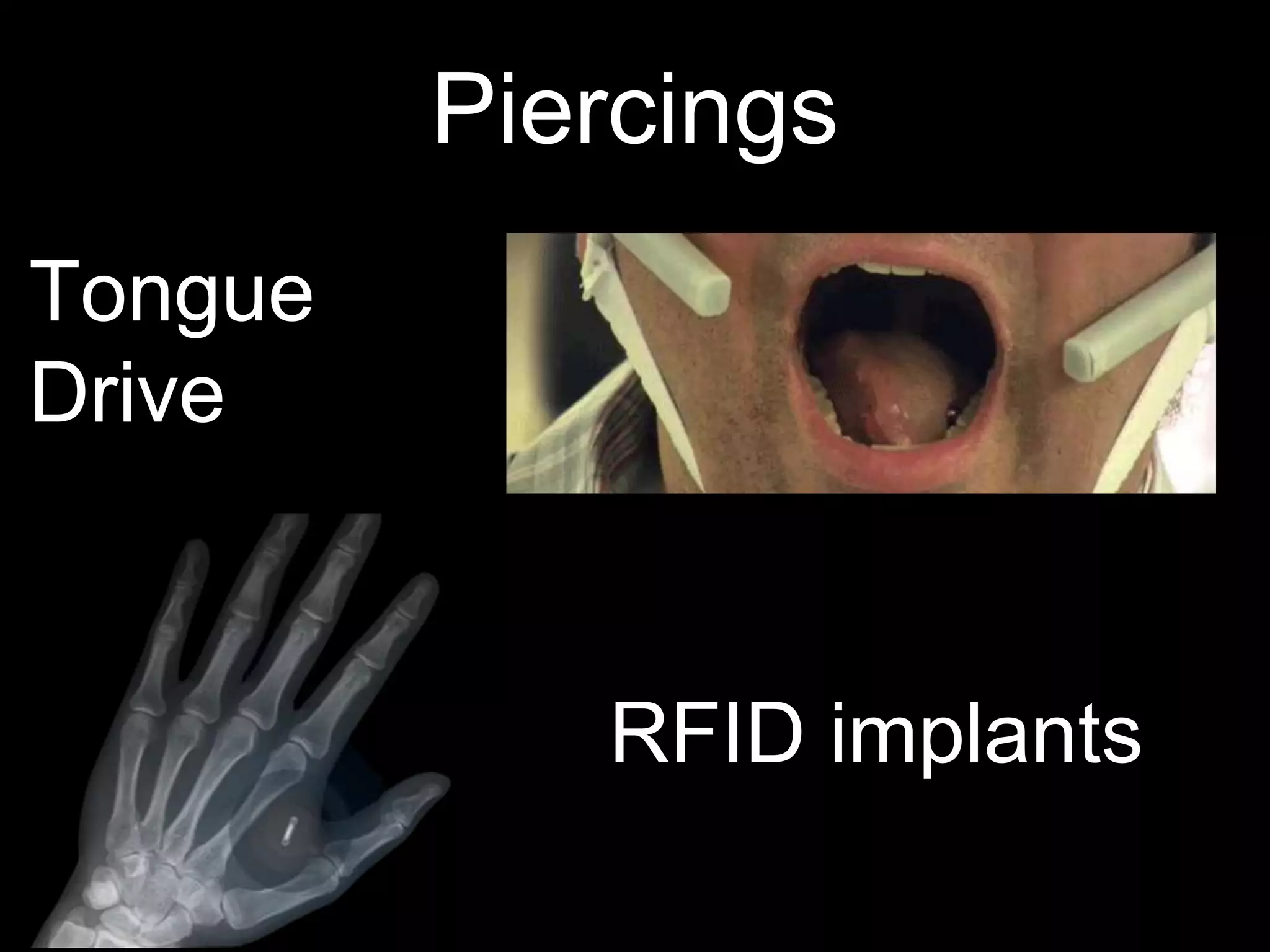 Piercings
Tongue
Drive
RFID implants
 