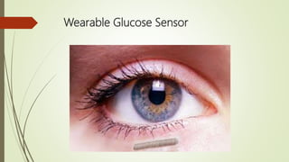 Wearable Glucose Sensor
 
