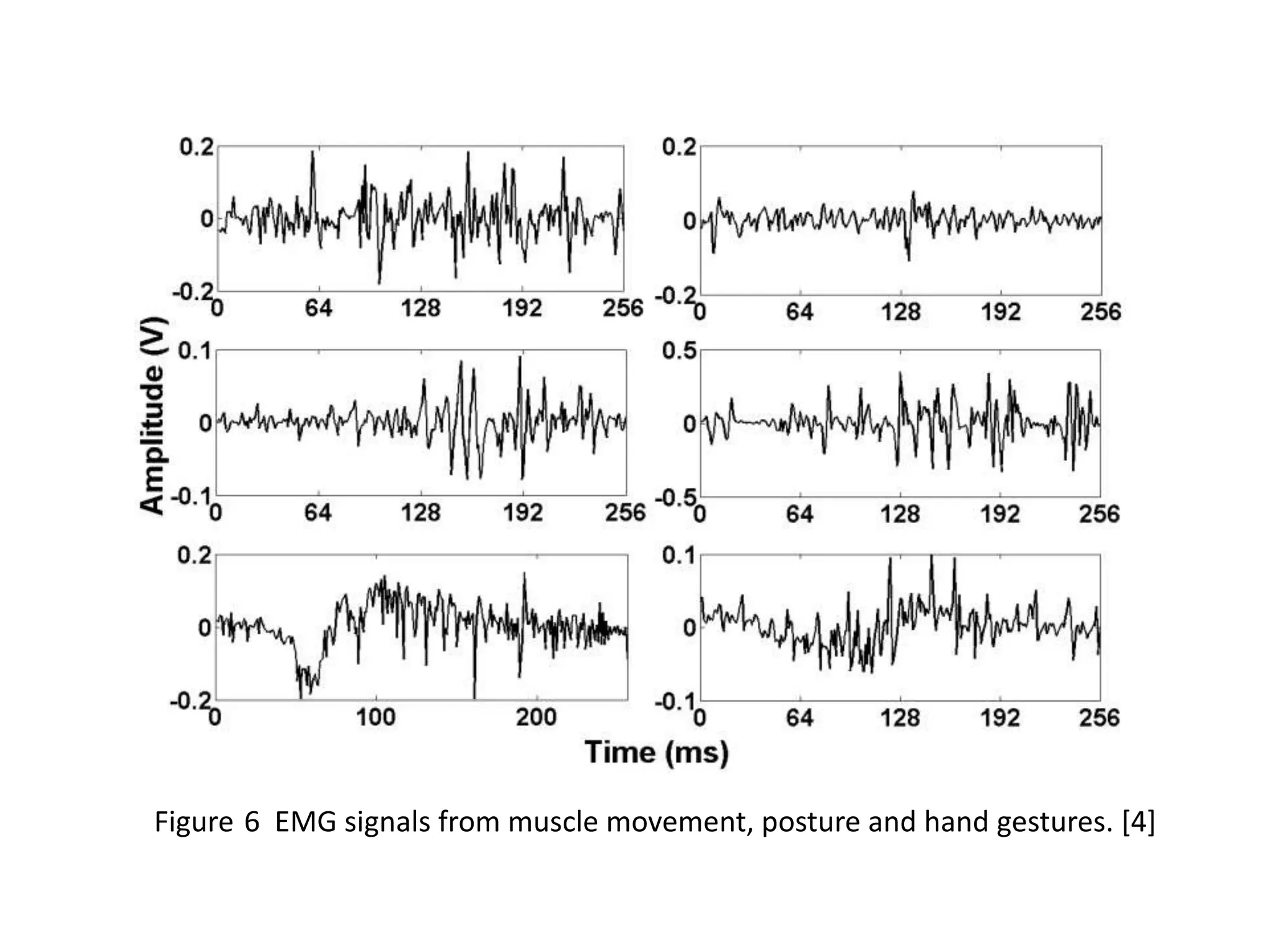 Figure 6 EMG signals from muscle movement, posture and hand gestures. [4]

 
