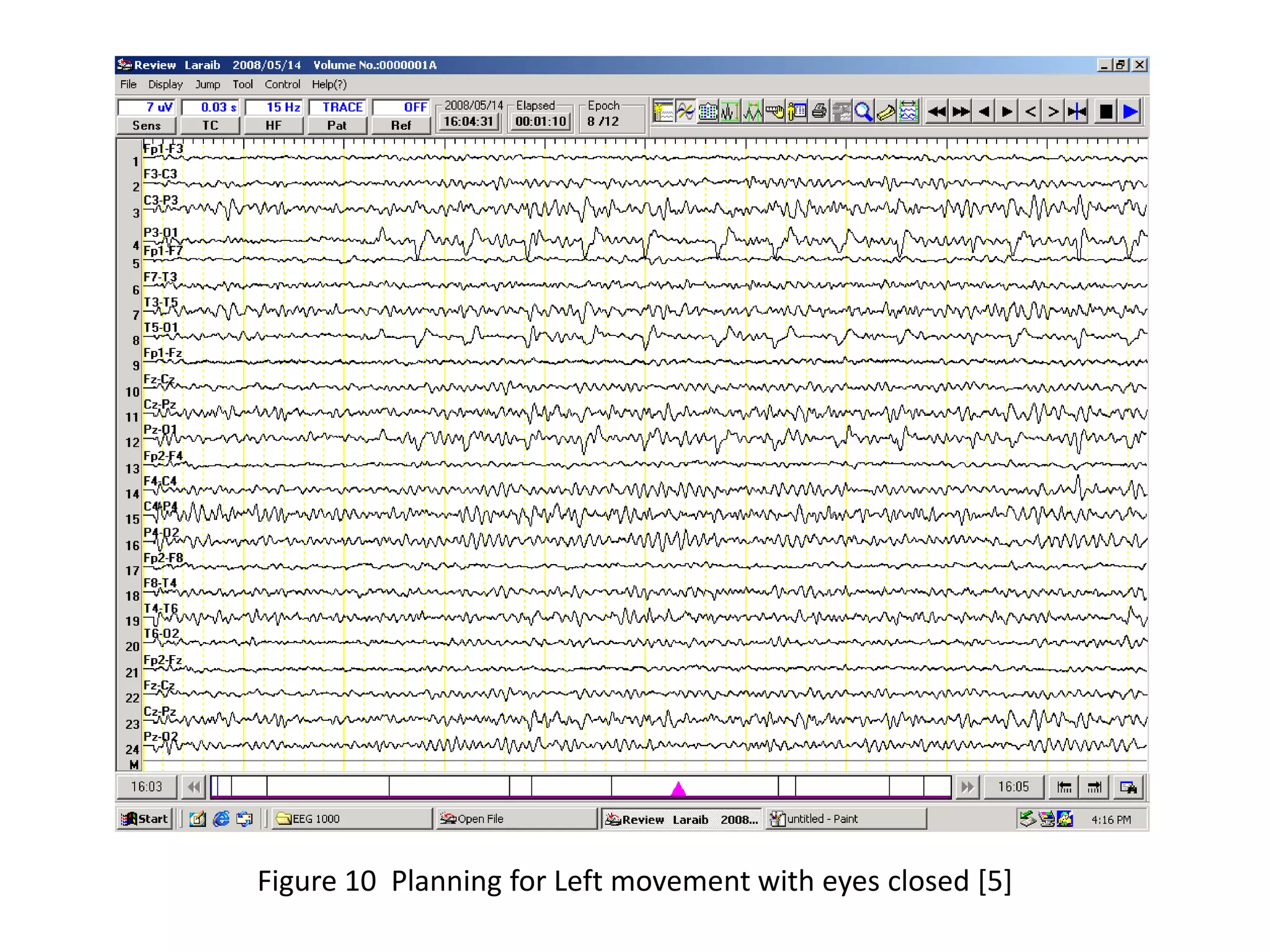 Figure 10 Planning for Left movement with eyes closed [5]

 