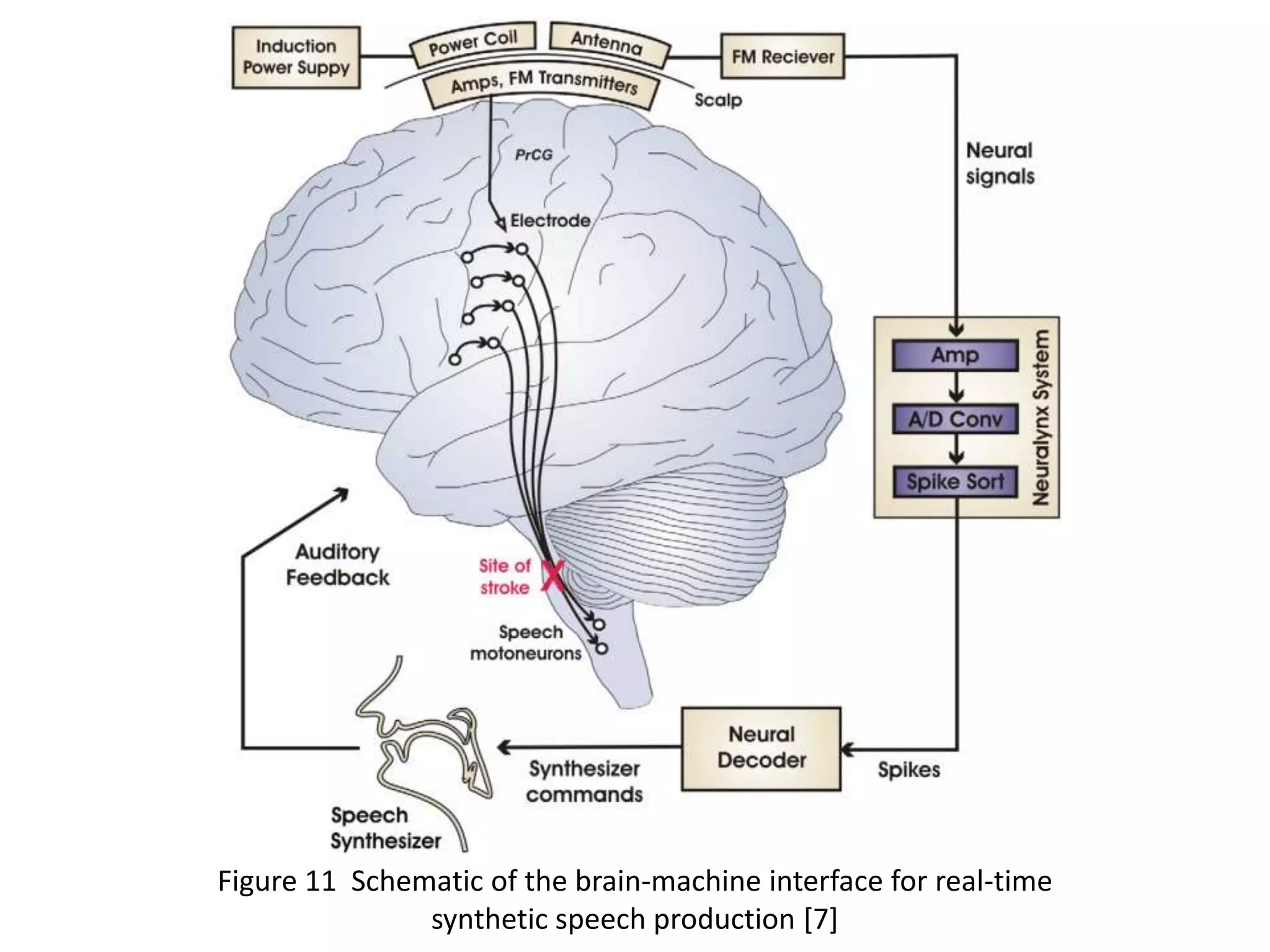 Figure 11 Schematic of the brain-machine interface for real-time
synthetic speech production [7]

 
