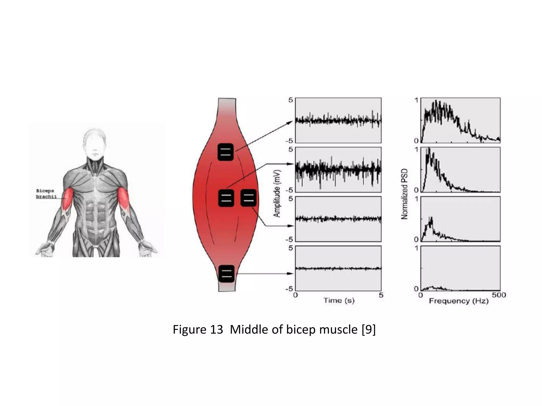 Figure 13 Middle of bicep muscle [9]

 