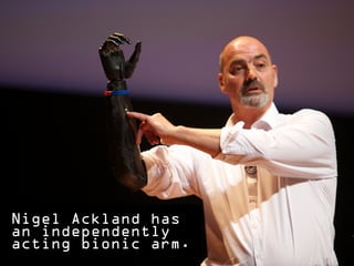 Nigel Ackland has
an independently
acting bionic arm.
 