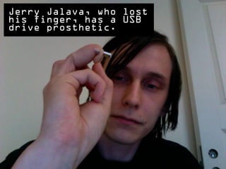Jerry Jalava, who lost
his finger, has a USB
drive prosthetic.
 