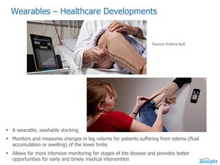 Wearables  – Healthcare  Developments  
Source:  Edema  ApS
§ A  wearable,  washable  stocking
§ Monitors  and  measures  changes  in  leg  volume  for  patients  suffering  from  edema  (fluid  
accumulation  or  swelling)  of  the  lower  limbs
§ Allows  for  more  intensive  monitoring  for  stages  of  the  disease  and  provides  better  
opportunities  for  early  and  timely  medical  intervention
 
