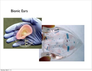 Bionic Ears

Saturday, March 1, 14

 