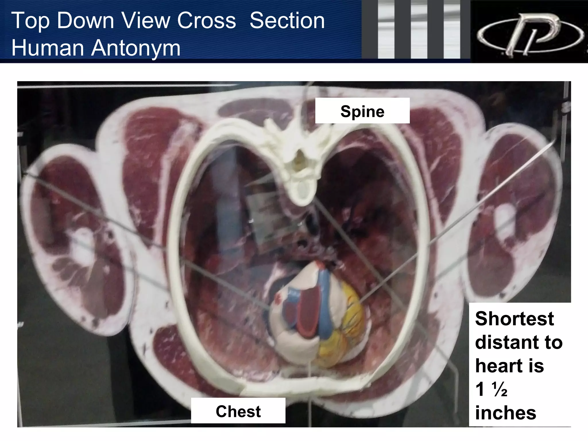 LEOKA 2010
Top Down View Cross Section
Human Antonym
Chest
Spine
Shortest
distant to
heart is
1 ½
inches
 