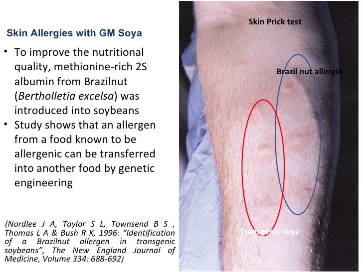 IDENTIFICATION OF A BRAZILNUT ALLERGEN IN TRANSGENIC SOYBEANS PDF
