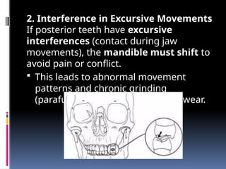 Sever teeth Wear Management By Mohamed Sawi.pptx