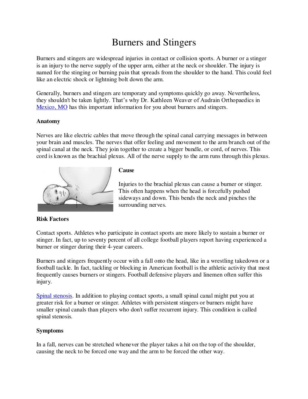 Burners and Stingers