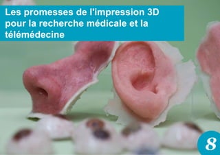 8
Les promesses de l'impression 3D
pour la recherche médicale et la
télémédecine
 
