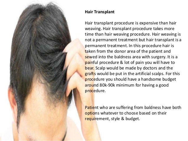 What Would Be Better Hair Weaving Or Hair Transplant