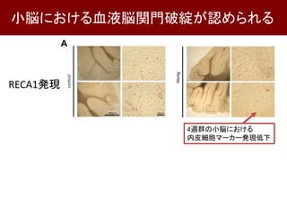 小脳における血液脳関門破綻が認められる
RECA1発現
4週群の小脳における
内皮細胞マーカー発現低下
 