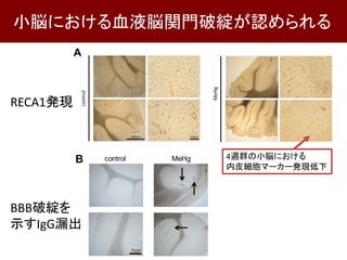 小脳における血液脳関門破綻が認められる
RECA1発現
BBB破綻を
示すIgG漏出
4週群の小脳における
内皮細胞マーカー発現低下
 