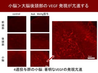 4週投与群の小脳：著明なVEGFの発現亢進
小脳＞大脳後頭部の VEGF 発現が亢進する
 