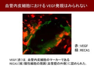 VEGF（赤）は，血管内皮細胞のマーカーである
RECA1（緑）陽性細胞の周囲（血管腔の外側）に認められた．
赤：VEGF
緑：RECA1
血管内皮細胞における VEGF発現はみられない
 