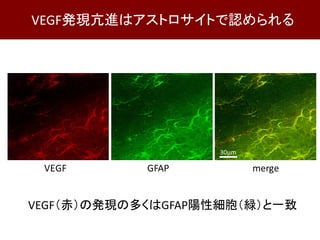 VEGF（赤）の発現の多くはGFAP陽性細胞（緑）と一致
VEGF発現亢進はアストロサイトで認められる
 