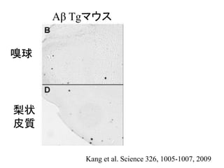 Kang et al. Science 326, 1005-1007, 2009
梨状
皮質
Aβ Tgマウス
嗅球
 