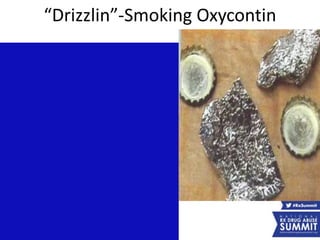 “Drizzlin”-Smoking Oxycontin
 