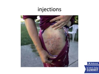 injections
 