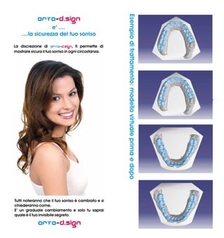 Orto
e’ ....
....la sicurezza del tuo sorriso
Orto
-
La discrezione di - ti permette di
mostrare sicura il tuo sorriso in ogni circostanza.
D.Sign
D.Sign,
Tutti noteranno che il tuo sorriso è cambiato e si
chiederanno come.
E’ un graduale cambiamento e solo tu saprai
quale è il tuo invisibile segreto.
-Orto d.sign
Chiedi al tuo odontoiatra tutte le
informazioni sul trattamento
Orto-d.sign
KEYS DS di Angelo Magni
Via XXV Aprile, 5
24040 Fornovo San Giovanni (BG)
Tel. e Fax 0363.337.526
Cel. 335.8419830
www.keysds.it
info@keysds.it
Con Orto
Orto
Orto
-
tutto è sotto il tuo controllo.
Il trattamento - è composto da una serie di
mascherine in plastica che incorporano i movimenti dei
denti programmati dall’operatore.
Per il paziente utilizzare il trattamento - è
semplice: basta inserire la mascherina trasparente sui
denti e da subito inizierà ad applicare una delicata
forza, portandoli nella posizione programmata.
Alla fine della sua funzione, la mascherina viene
sostituita con quella successiva che si comporterà nello
stesso modo della precedente.
d.sign...
d.sign
d.sign
Esempioditrattamento:modellovirtualeprimaedopo
 