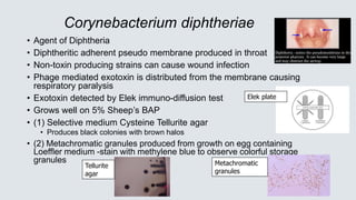 Corynebacterium diphtheriae
• Agent of Diphtheria
• Diphtheritic adherent pseudo membrane produced in throat
• Non-toxin producing strains can cause wound infection
• Phage mediated exotoxin is distributed from the membrane causing
respiratory paralysis
• Exotoxin detected by Elek immuno-diffusion test
• Grows well on 5% Sheep’s BAP
• (1) Selective medium Cysteine Tellurite agar
• Produces black colonies with brown halos
• (2) Metachromatic granules produced from growth on egg containing
Loeffler medium -stain with methylene blue to observe colorful storage
granules
Elek plate
Tellurite
agar
Metachromatic
granules
 