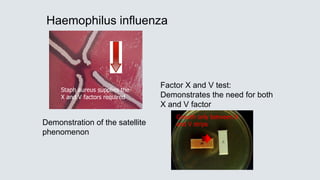 Haemophilus influenza
Growth only between X
and V strips
Staph aureus supplies the
X and V factors required
Factor X and V test:
Demonstrates the need for both
X and V factor
Demonstration of the satellite
phenomenon
 