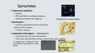 Spirochetes
• Treponema pallidum
• Syphilis
• RPR and VDRL for antibody detection
• Molecular methods for diagnosis
• Brachyspira –
• intestinal spirochete found on the brush
border of the intestine,
• ?? Role in disease
• Leptospira interrogans – Leptospirosis
• Fever with rash and renal involvement
• Urine from rats and other animals contaminate water supplies
Darkfield from chancre lesion
(1) Leptospirosis – Shepherd’s crook
(2) Presence of spirochete in a renal
tubule
(1) (2)
 