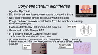 Corynebacterium diphtheriae
• Agent of Diphtheria
• Diphtheritic adherent pseudo membrane produced in throat
• Non-toxin p...