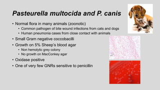 Pasteurella multocida and P. canis
• Normal flora in many animals (zoonotic)
• Common pathogen of bite wound infections from cats and dogs
• Human pneumonia cases from close contact with animals
• Small Gram negative coccobacilli
• Growth on 5% Sheep’s blood agar
• Non hemolytic grey colony
• No growth on MacConkey agar
• Oxidase positive
• One of very few GNRs sensitive to penicillin
 