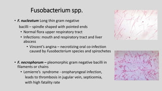 Fusobacterium spp.
• F. nucleatum Long thin gram negative
bacilli – spindle shaped with pointed ends
• Normal flora upper respiratory tract
• Infections: mouth and respiratory tract and liver
abscess
• Vincent’s angina – necrotizing oral co-infection
caused by Fusobacterium species and spirochetes
• F. necrophorum – pleomorphic gram negative bacilli in
filaments or chains
• Lemierre’s syndrome - oropharyngeal infection,
leads to thrombosis in jugular vein, septicemia,
with high fatality rate
 