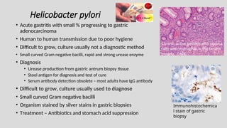 Helicobacter pylori
• Acute gastritis with small % progressing to gastric
adenocarcinoma
• Human to human transmission due to poor hygiene
• Difficult to grow, culture usually not a diagnostic method
• Small curved Gram negative bacilli, rapid and strong urease enzyme
• Diagnosis
• Urease production from gastric antrum biopsy tissue
• Stool antigen for diagnosis and test of cure
• Serum antibody detection obsolete – most adults have IgG antibody
• Difficult to grow, culture usually used to diagnose
• Small curved Gram negative bacilli
• Organism stained by silver stains in gastric biopsies
• Treatment – Antibiotics and stomach acid suppression
Immunohistochemica
l stain of gastric
biopsy
Chronic active gastritis with plasma
cells and neutrophils in the lamina
propria. (H&E)
 