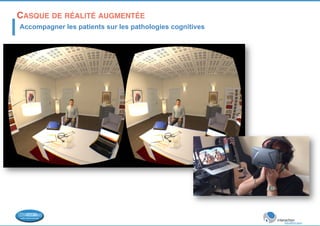 CASQUE DE RÉALITÉ AUGMENTÉE! 
Accompagner les patients sur les pathologies cognitives 
 