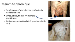 Mammite chronique
• Conséquence d’une infection profonde du
tissu mammaire
• Kystes, abcès, fibrose => mamelle
asymétrique
• Diminution production lait: 1 quartier valable
sur 2
Abcès mammaires