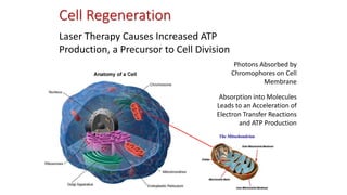 Cell Regeneration
Laser Therapy Causes Increased ATP
Production, a Precursor to Cell Division
Photons Absorbed by
Chromophores on Cell
Membrane
Absorption into Molecules
Leads to an Acceleration of
Electron Transfer Reactions
and ATP Production
 