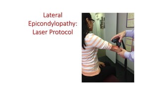 Lateral
Epicondylopathy:
Laser Protocol
 