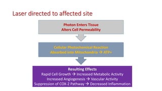Laser directed to affected site
Photon Enters Tissue
Alters Cell Permeability
Cellular Photochemical Reaction
Absorbed into Mitochondria  ATP+
Resulting Effects
Rapid Cell Growth  Increased Metabolic Activity
Increased Angiogenesis  Vascular Activity
Suppression of COX-2 Pathway  Decreased Inflammation
 
