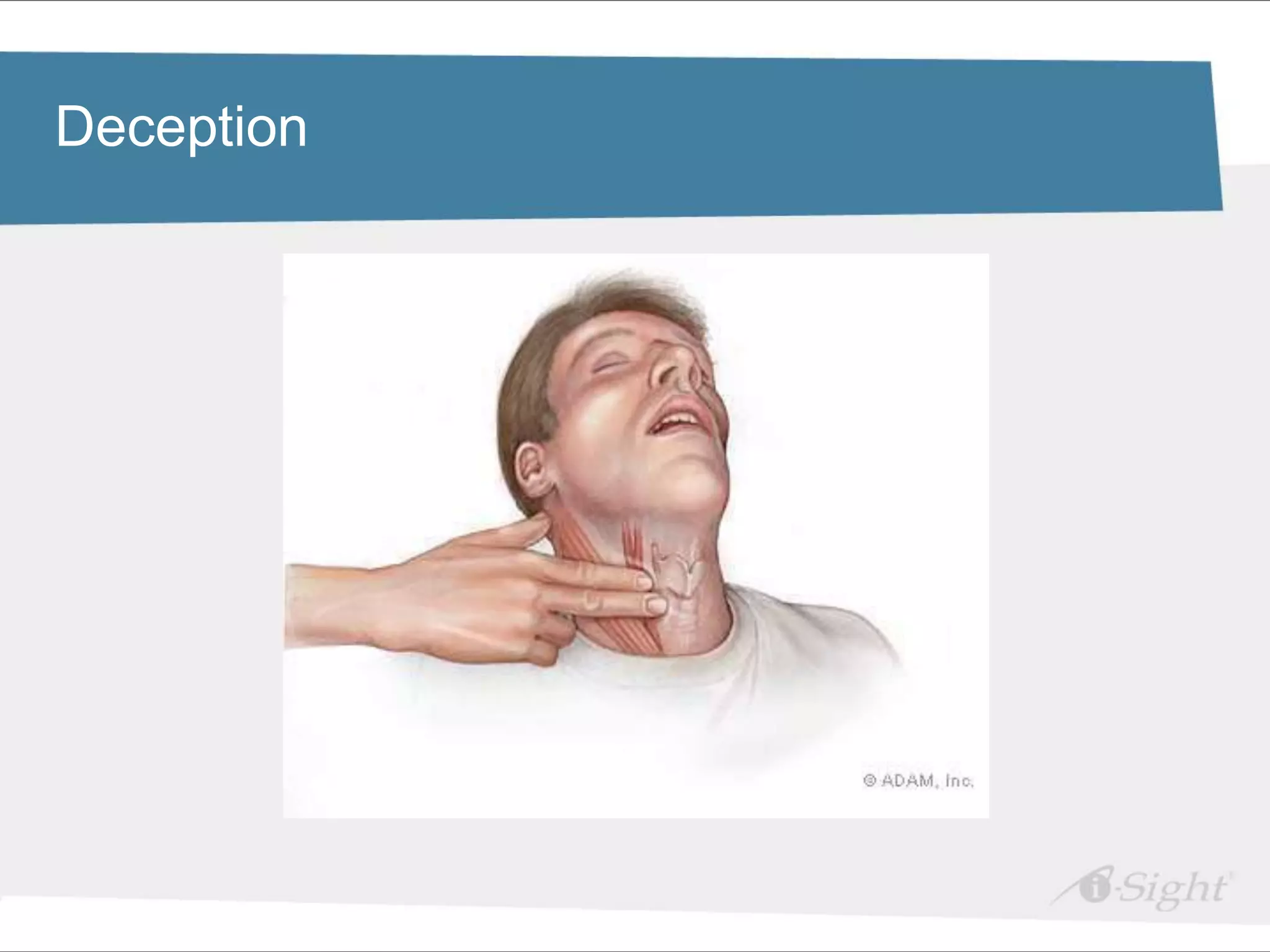 Deception edit Master title style
 Click to

•   Click to edit Master text styles
     - fdsfds
 