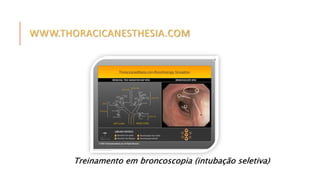 WWW.THORACICANESTHESIA.COM 
Treinamento em broncoscopia (intubação seletiva) 
 