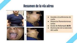 Resumen de la vía aérea
● Grandes circunferencias de
cuello
● Distancias filomentonianas
cortas
● Escala de Mallampati ALTO
● Disminución de la extensión
del cuello