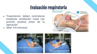 ★ Tratamiento: deben controlarse
mediante ventilación nasal con
presión positiva antes de la
operación
★ Ideal 4-6 semanas
Evaluación respiratoria
 
