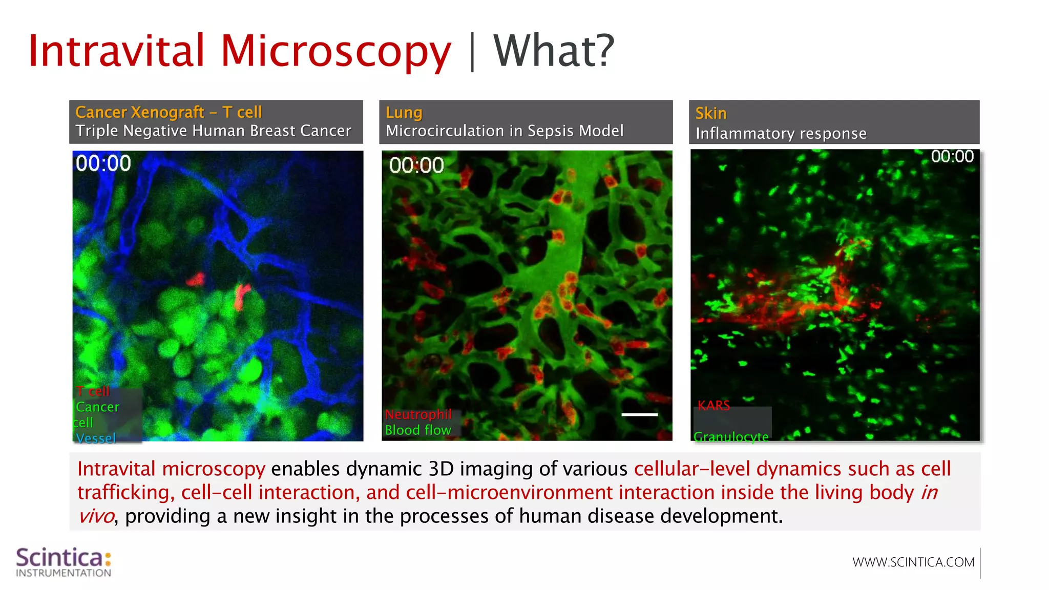 WWW.SCINTICA.COM
Skin
Inflammatory response
KARS
Granulocyte
Intravital Microscopy | What?
Intravital microscopy enables dynamic 3D imaging of various cellular-level dynamics such as cell
trafficking, cell-cell interaction, and cell-microenvironment interaction inside the living body in
vivo, providing a new insight in the processes of human disease development.
Cancer Xenograft - T cell
Triple Negative Human Breast Cancer
T cell
Cancer
cell
Vessel
Lung
Microcirculation in Sepsis Model
Neutrophil
Blood flow
 