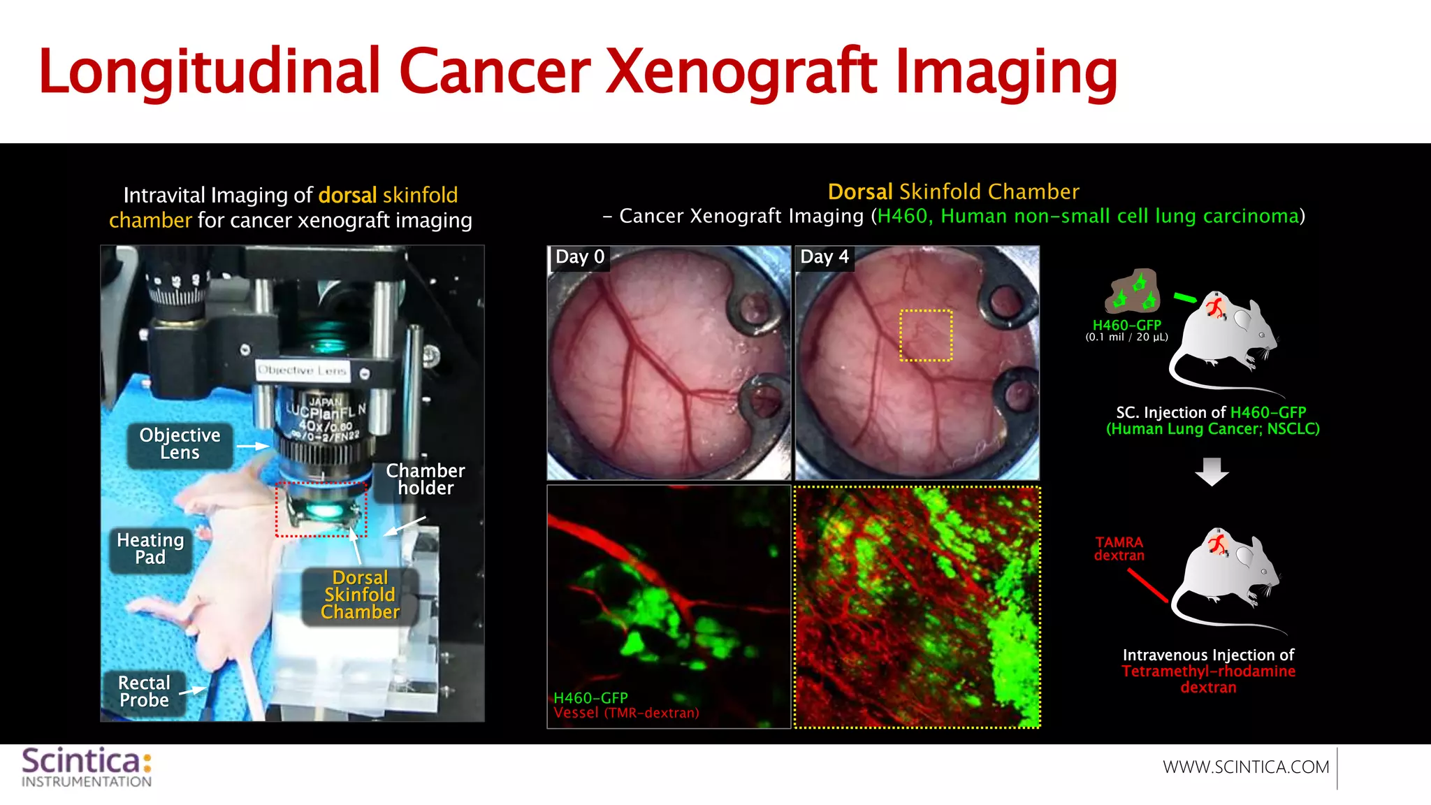 WWW.SCINTICA.COM
Longitudinal Cancer Xenograft Imaging
Intravital Imaging of dorsal skinfold
chamber for cancer xenograft imaging
Objective
Lens
Heating
Pad
Rectal
Probe
Chamber
holder
Dorsal
Skinfold
Chamber
Dorsal Skinfold Chamber
- Cancer Xenograft Imaging (H460, Human non-small cell lung carcinoma)
Day 0 Day 4
SC. Injection of H460-GFP
(Human Lung Cancer; NSCLC)
H460-GFP
(0.1 mil / 20 μL)
Intravenous Injection of
Tetramethyl-rhodamine
dextran
TAMRA
dextran
H460-GFP
Vessel (TMR-dextran)
 